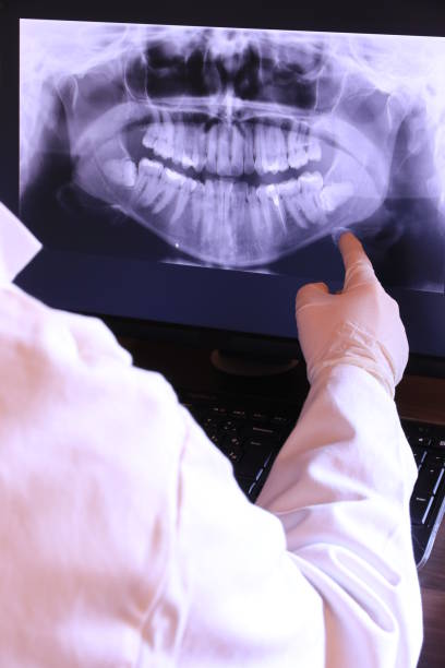 Best Emergency Root Canal Treatment in Urbana, IA