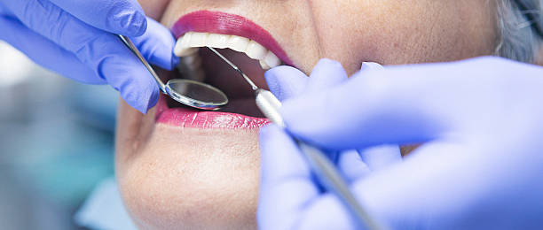 Best Emergency Dental Extractions in Urbana, IA